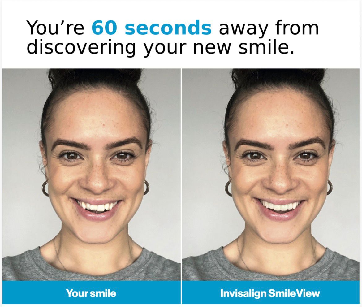 Invisalign SmileView